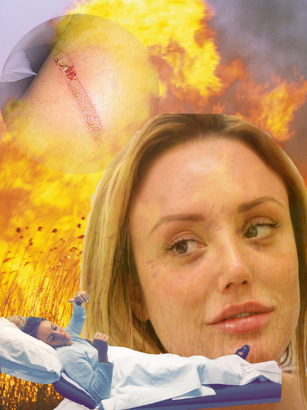 WHAT has happened to Geordie Shore star Charlotte Crosby’s leg!?