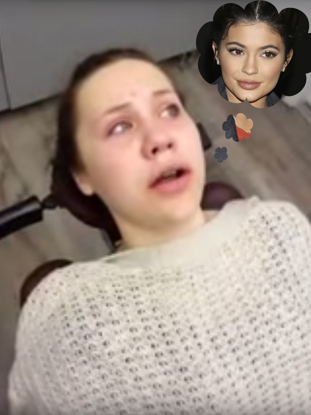 OMG! Girl wakes up from surgery believing she is Kylie Jenner and it is AMAZING