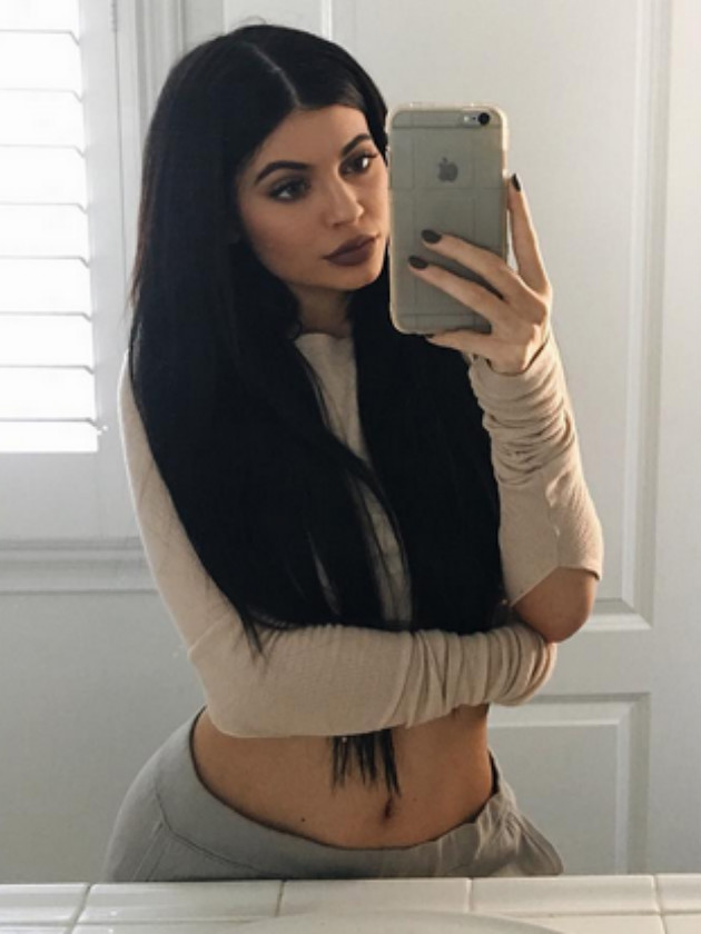 ‘I wasn’t telling the whole truth’: Kylie Jenner gets honest about lips and those surgery rumours