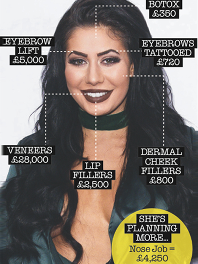 Geordie Shore’s £200,000 surgery bill!