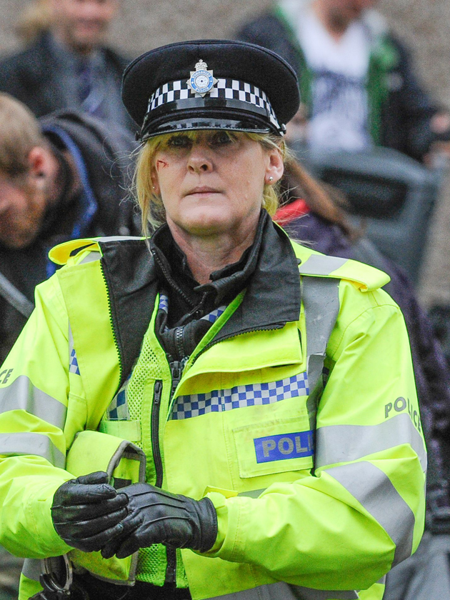Happy Valley star Sarah Lancashire opens up about her heartbreaking battle with depression