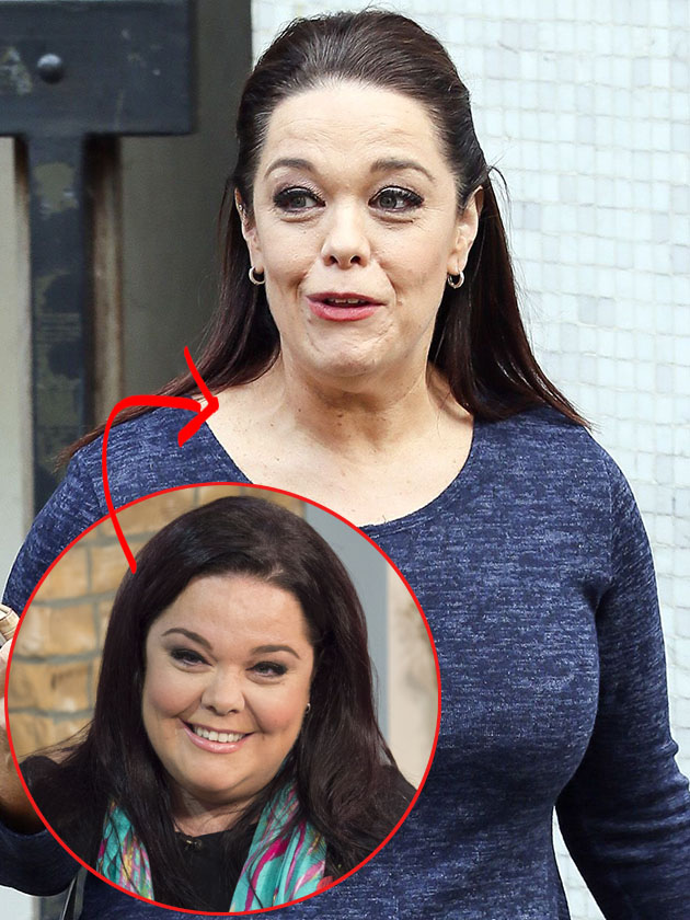 Has dramatic weight loss aged these stars?