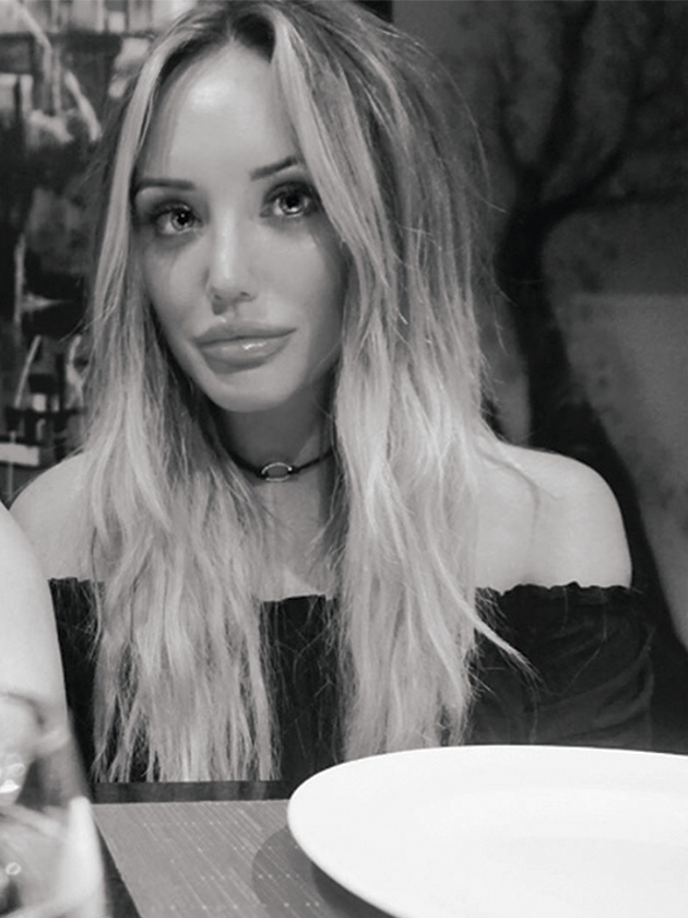 Fans tell Charlotte Crosby: ‘You’ve ruined your face!’
