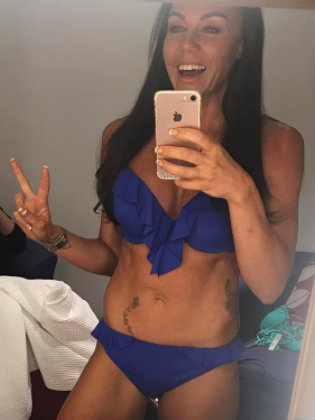 Brave Michelle Heaton strips down to bikini on Loose Women to talk about her surgical scars