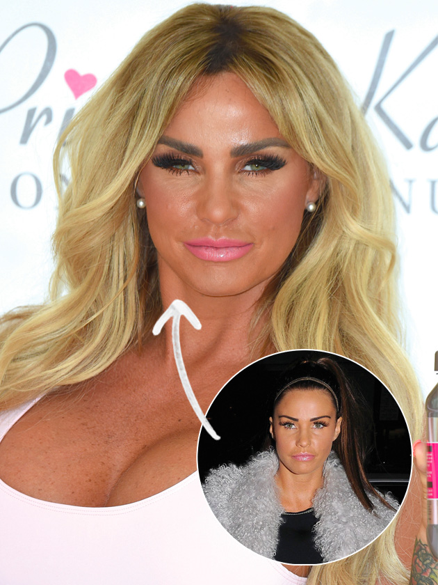 Kieran Hayler tells Katie Price: ‘Your surgery needs to stop!’