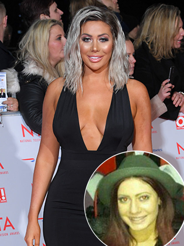 Chloe Ferry confirms boob job: See her transformation over the years