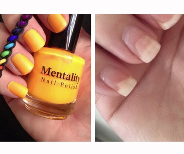 Mentality Nail Varnish Has Been Ruining Women S Nails Look Mentality Nail Varnish Has Been Ruining Women S Nails