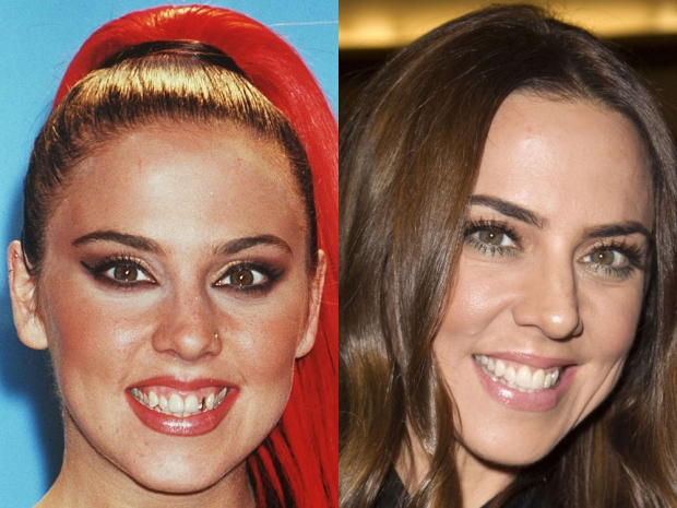 The Most Dazzling Celebrity Teeth Transformations Look