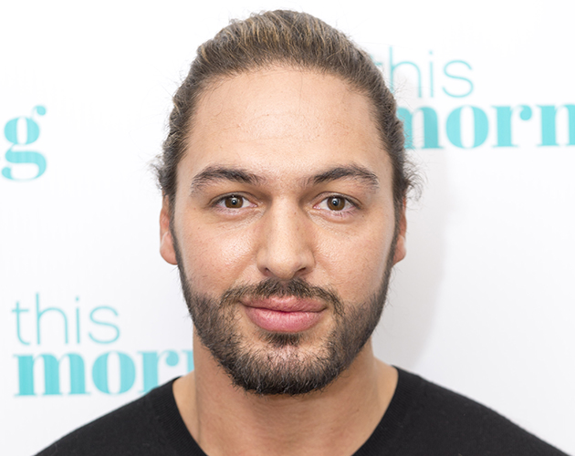 Mario Falcone Reveals The Results Of His Nose Job On This Morning