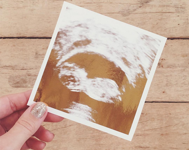 How To Know If You’re Going To Get Pregnant In 2017