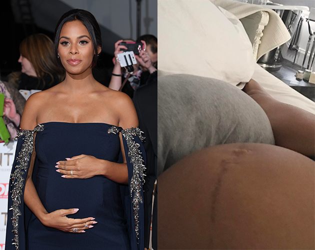 ‘What Is This Line Down My Tummy…?’ Rochelle Humes Reaches Out To Fans For Baby Bump Advice