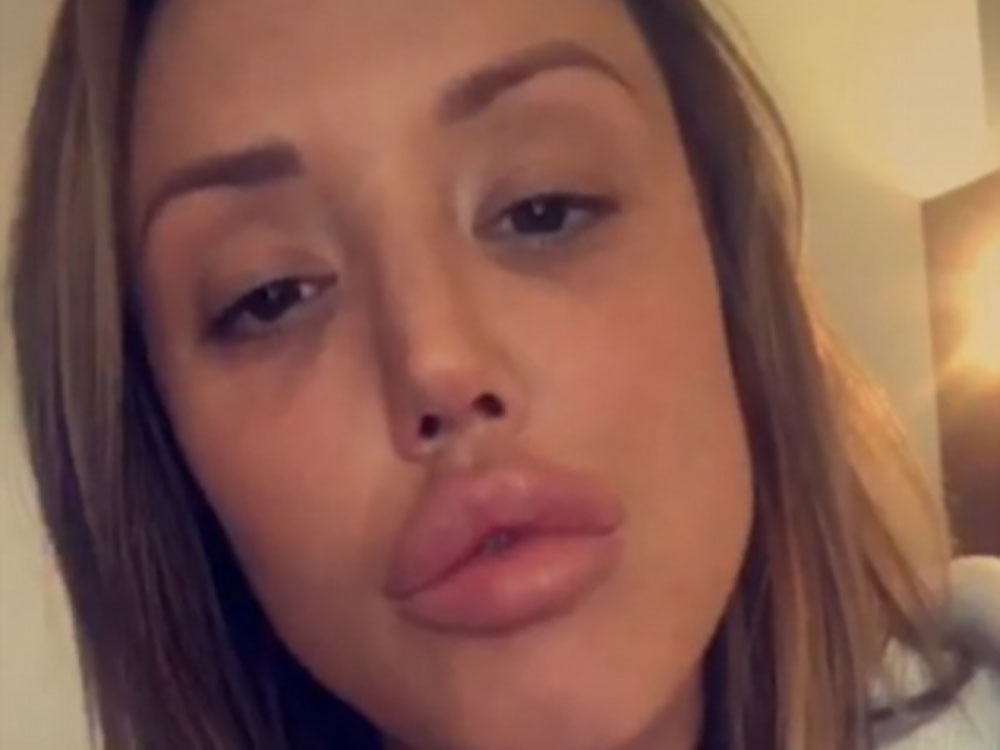 Charlotte Crosby Shows Off A VERY Full Pout During Rant On Snapchat