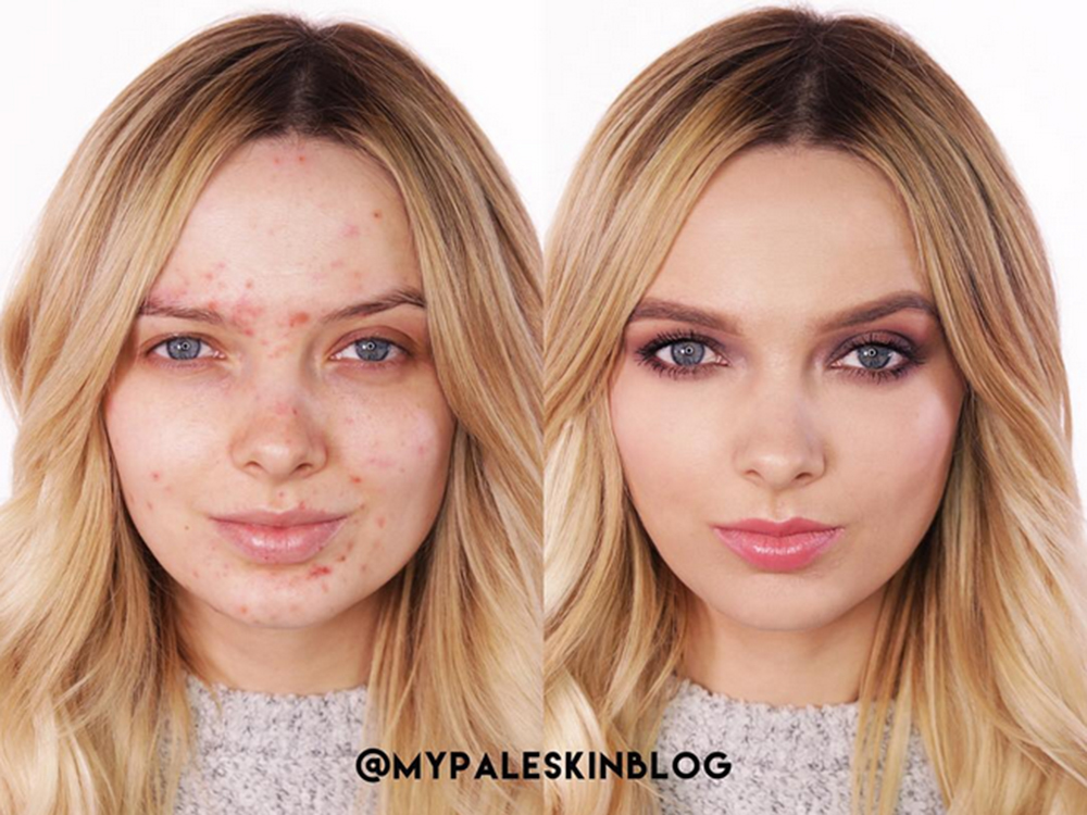 Beauty Blogger Em Ford Reveals Her Skincare Secrets
