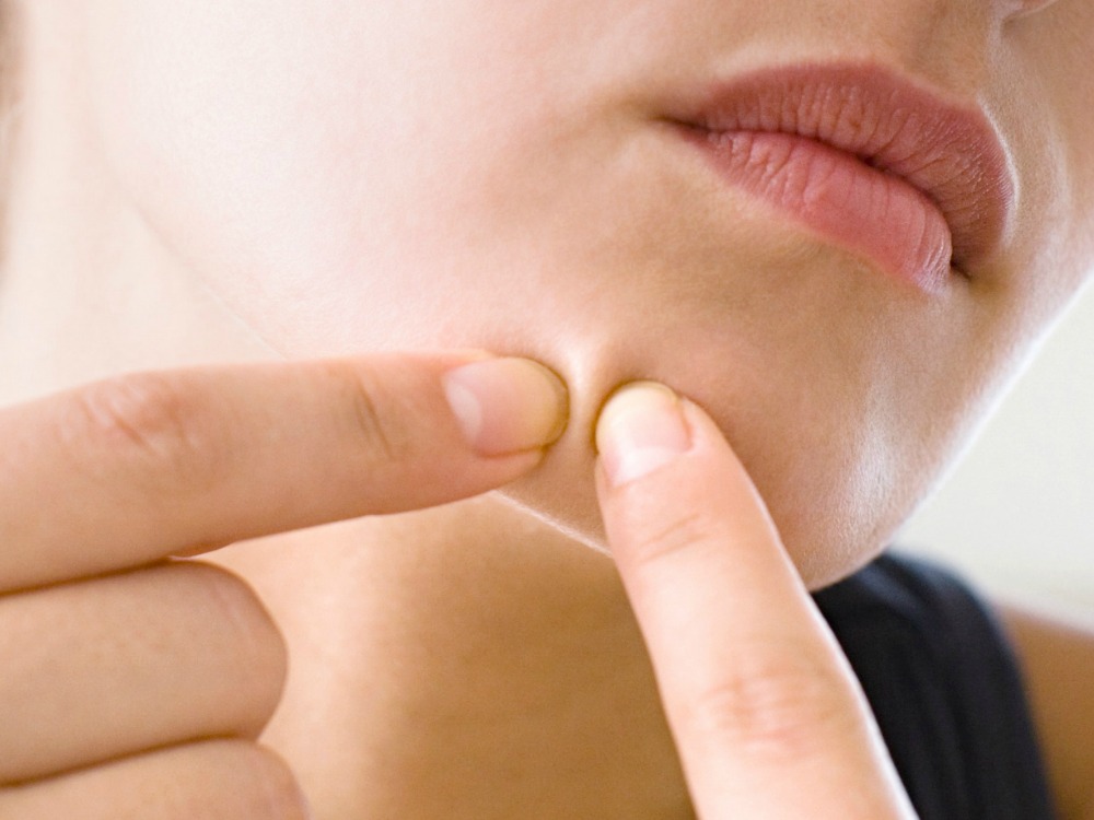 This Pore Vacuum Device Looks SO Satisfying