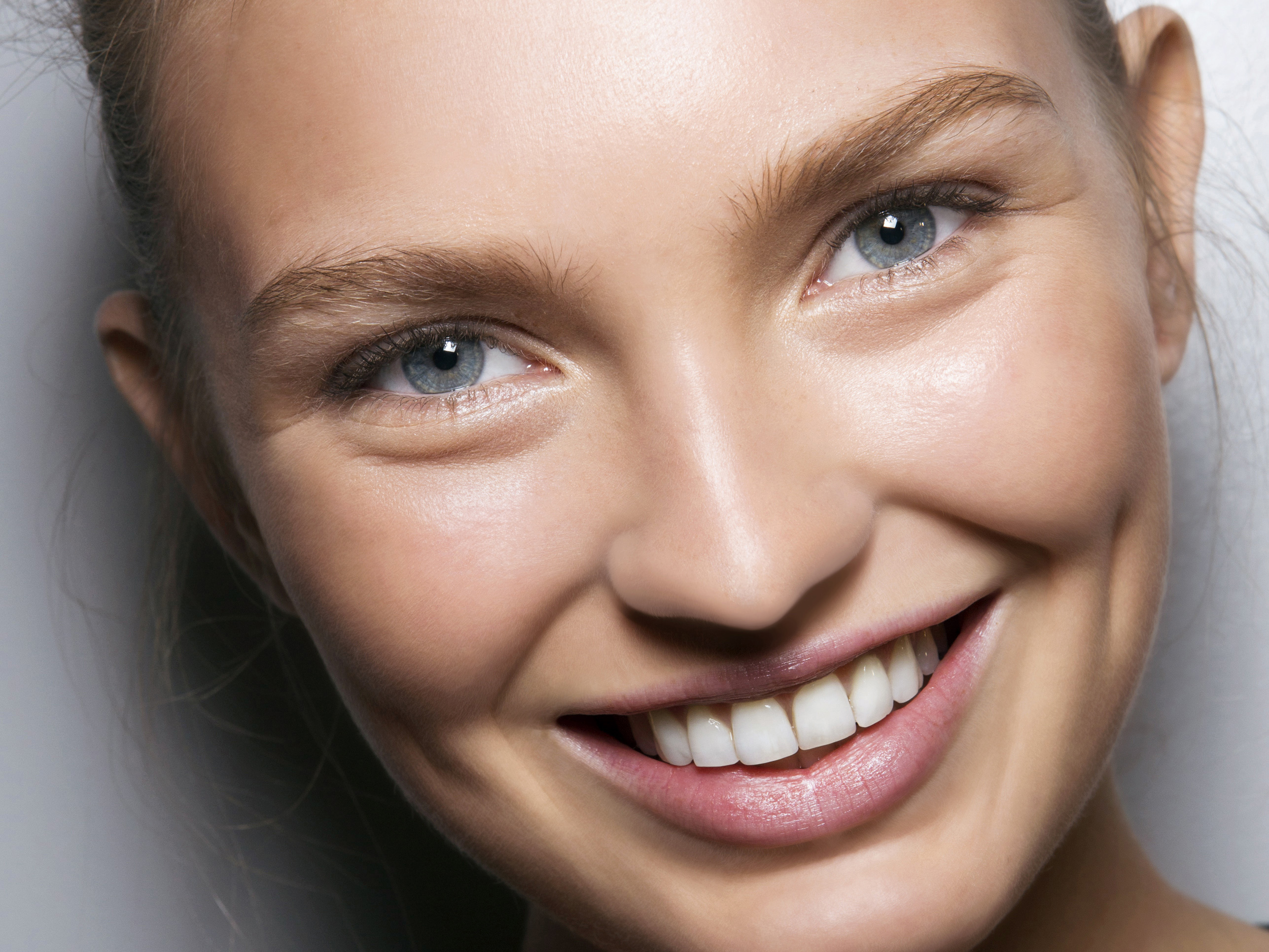 Everything You Need To Know About Adult Braces