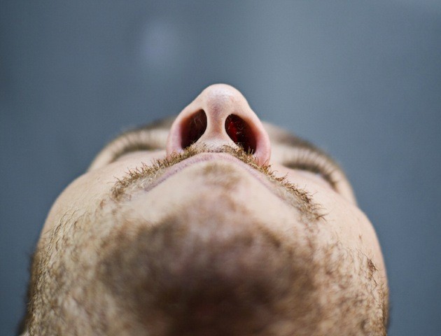 Dentist: view up dentist's nose