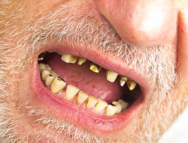 iStockphoto