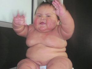 Doctors Struggle To Diagnose 10 Month Old Baby Who Weighs The Same As A 5 Year Old Doctors Struggle To Diagnose 10 Month Old Baby Who Weighs The Same As A 5 Year Old