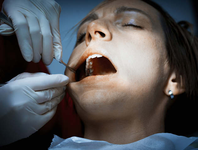 Woman having her mouth operated on