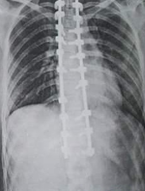 After surgery (Photo: Talk To The Press)