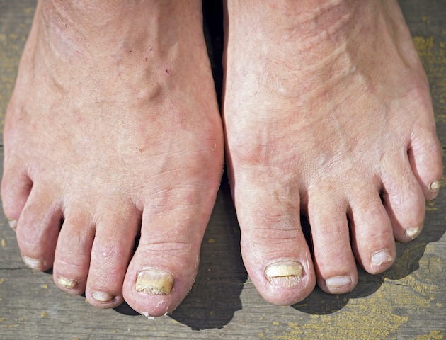 iStockphoto
