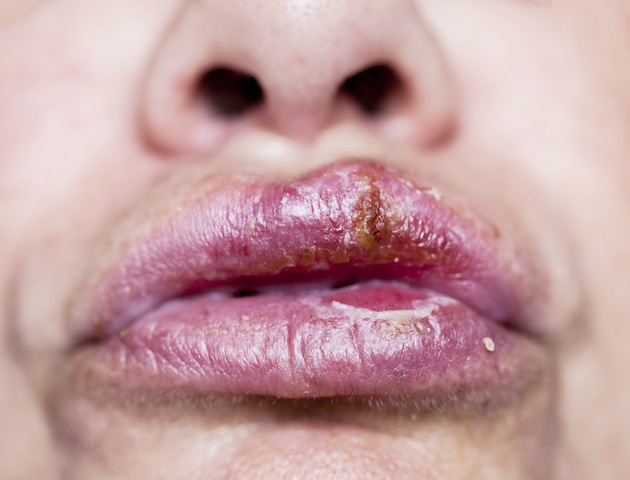 iStockphoto
