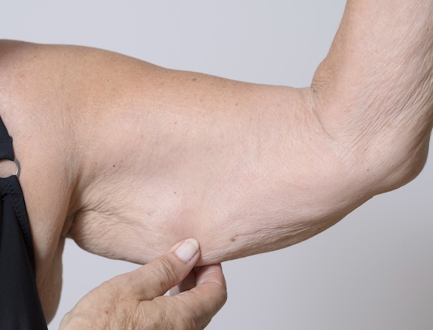 iStockphoto