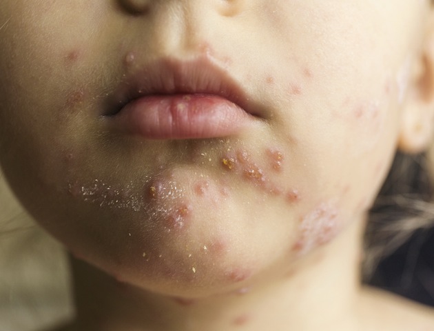 iStockphoto