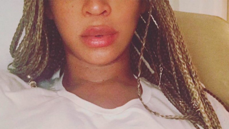 Has Beyoncé had lip fillers?