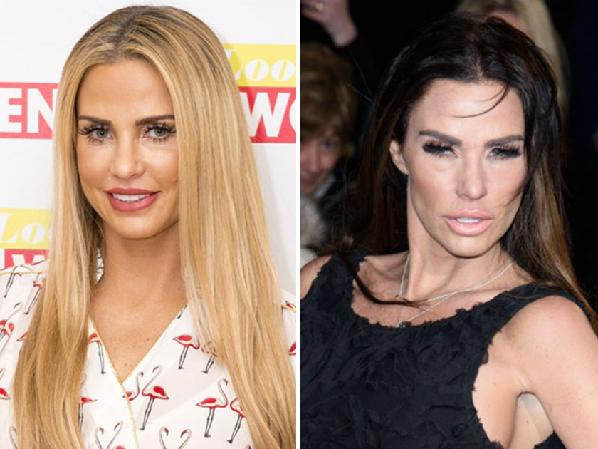 Katie Price shock photos: What have you done to your face?