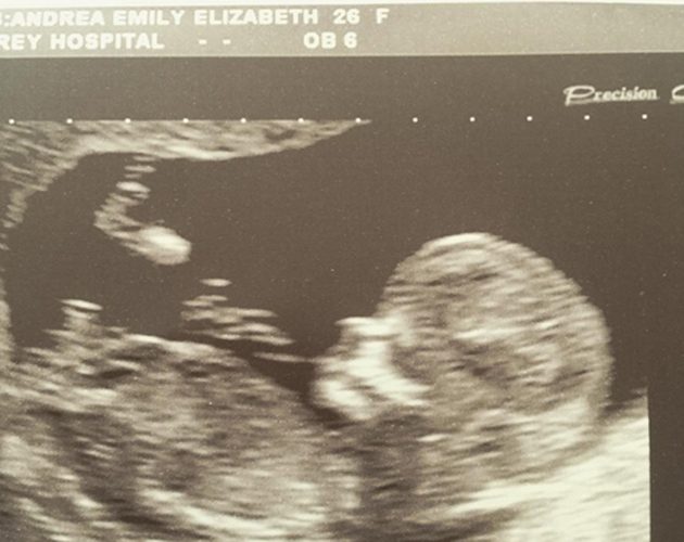 Peter Andre Emily MacDonagh scan