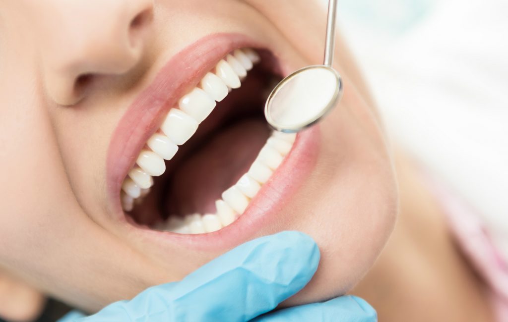 tooth decay