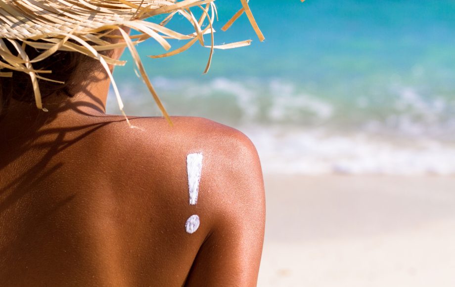 How to treat sunburn at home Sunburn remedies
