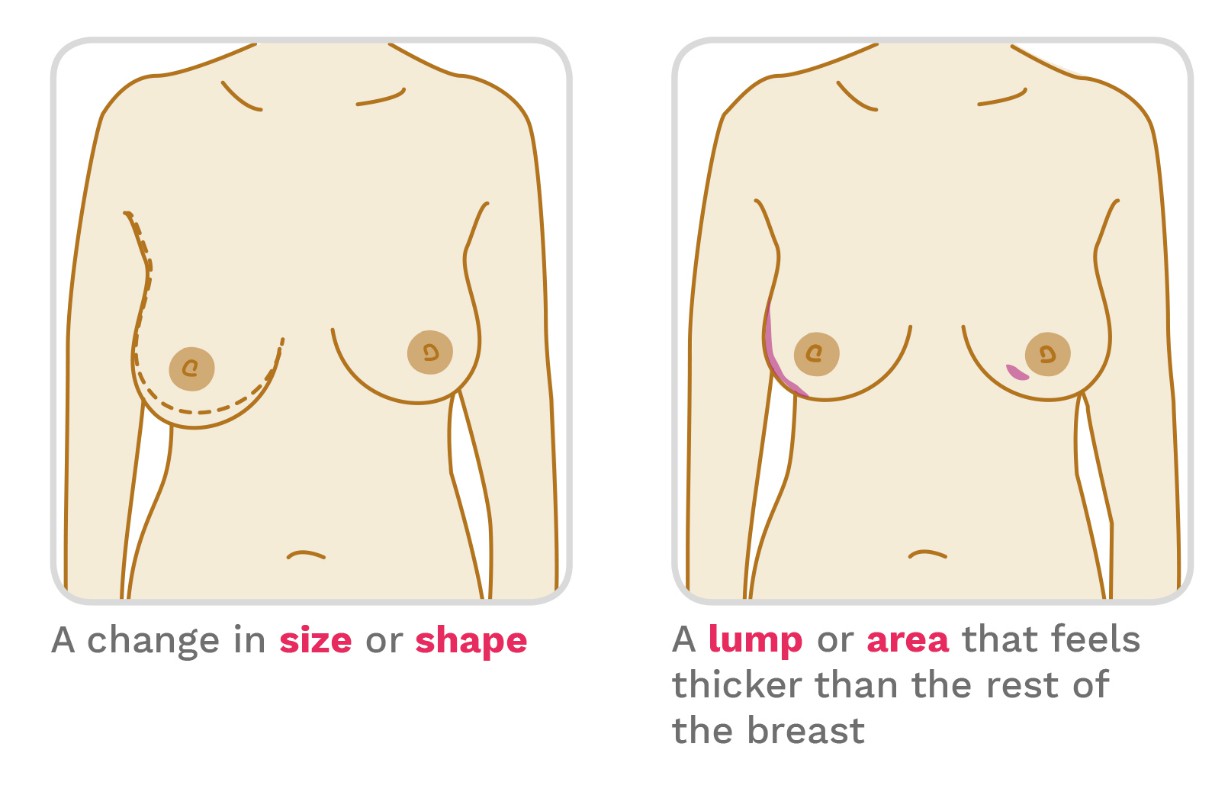 How to check your breasts
