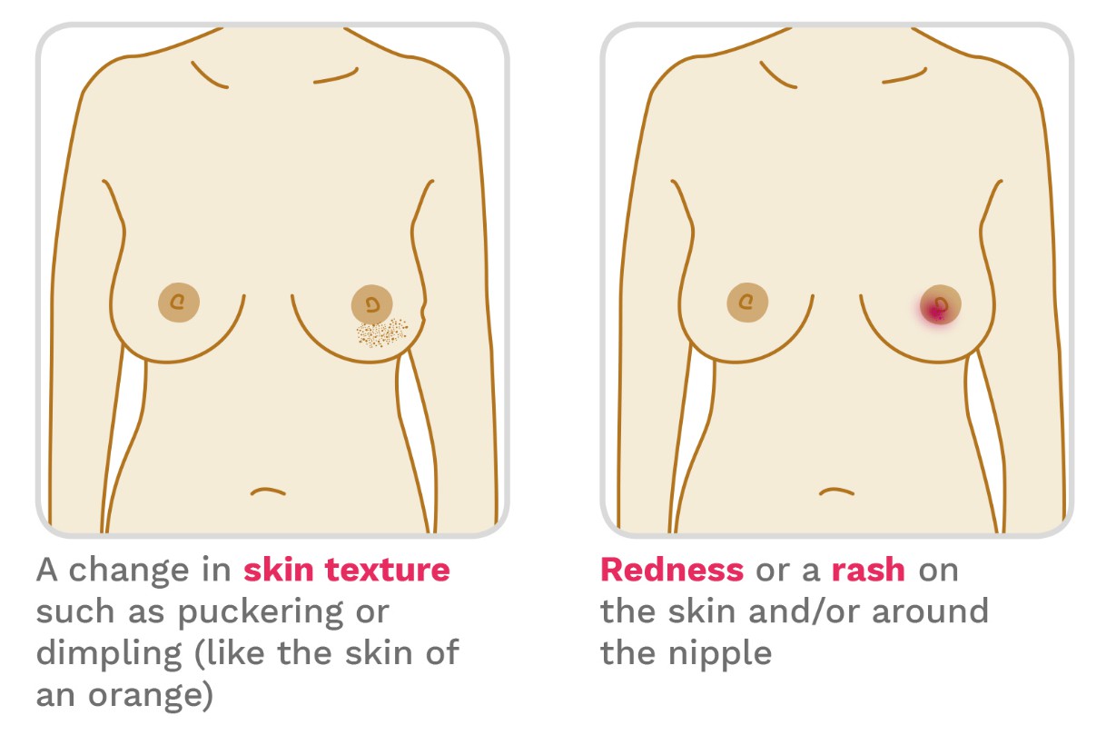 How to check your breasts