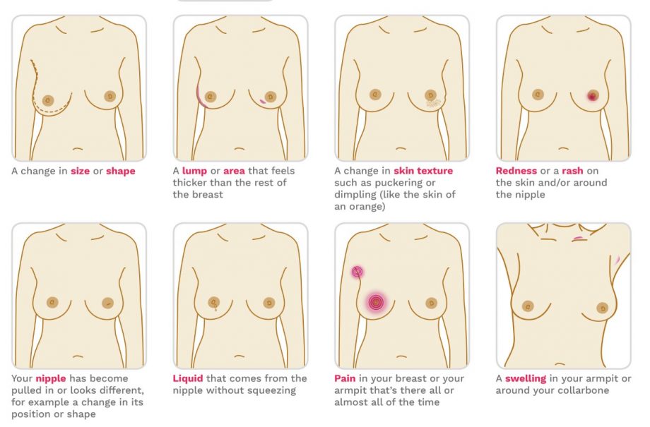 How to check your breasts