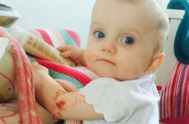 miracle eczema cream boots