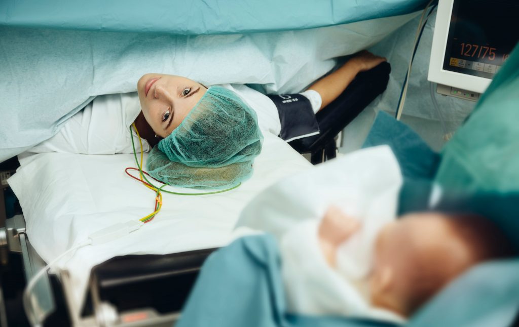 c-section