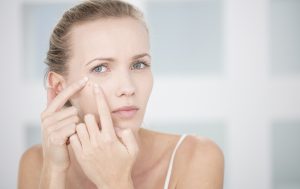 spots on different areas of your face, spots on cheek