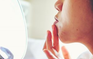 spots on different areas of your face, spots on chin