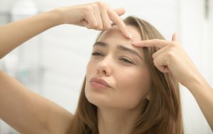 spots on different areas of your face, spots on forehead