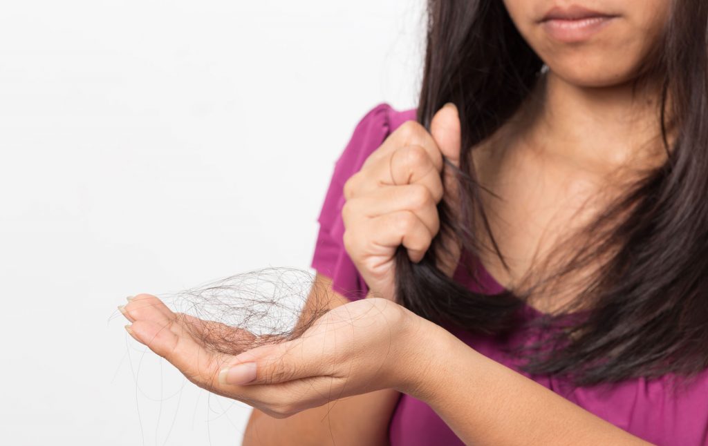 alopecia