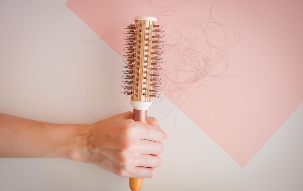 alopecia symptoms