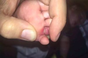 mum warning long hair cut baby toe