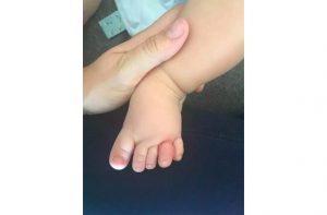 mum warning long hair cut baby toe