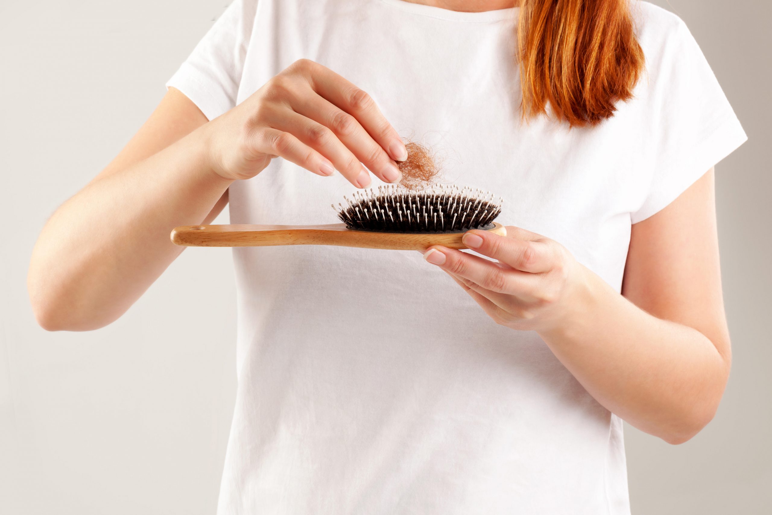Stress can cause hair loss