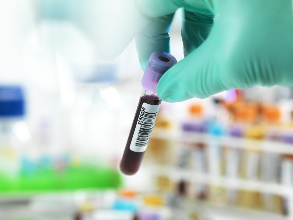 antibody test, blood test