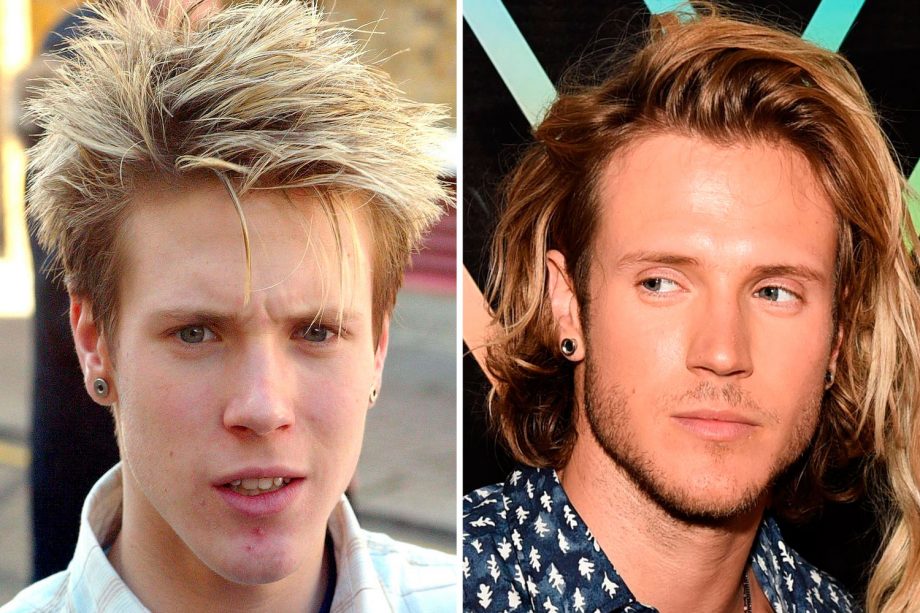 Dougie Poynter Hair Has Had A Serious Transformation From 2004 To 2015