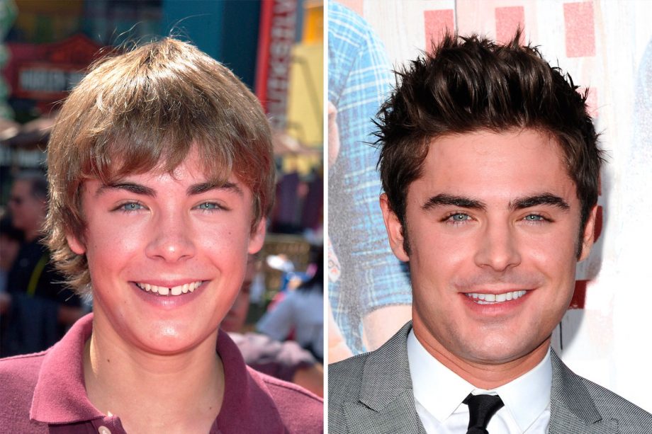 Zac Efron Looks An Awkward Teenager Back In 2004 And Looking All Man In 2015
