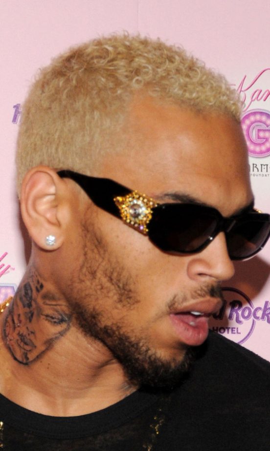 Chris Brown's Controversial Beat-Up Face, 2012